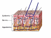 FUE vs FUT Hair Transplant Treatment | Ailesbury Hair Clinic