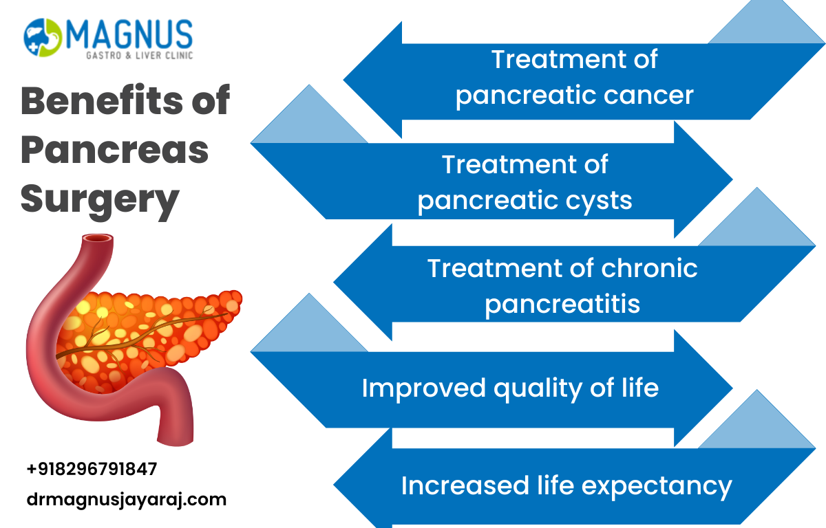 Pancreas Surgery In Chennai