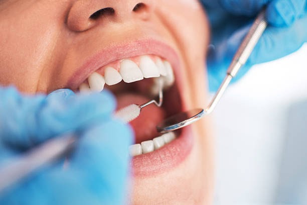 The List of Dental Services We Provide