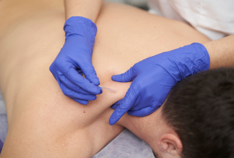 Dry Needling Melbourne: Relieve Pain and Restore Movement