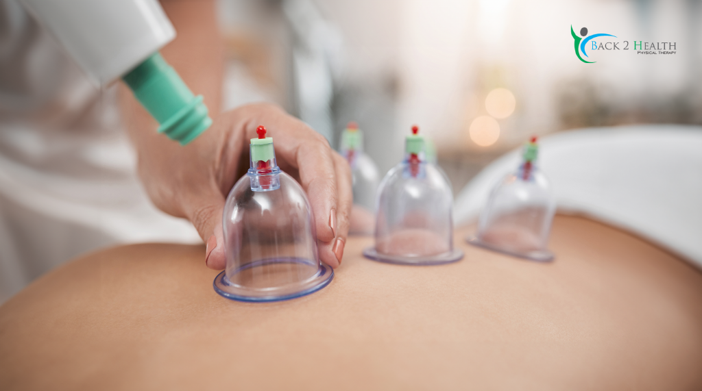 Cupping Therapy: Natural Muscle Recovery & Relaxation