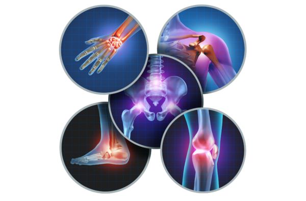 Top 5 Reasons for Joint and Muscle Pain - Patient Experts